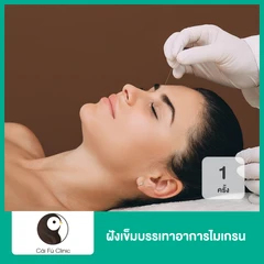 ฝังเข็มบรรเทาอาการไมเกรน 1 ครั้ง