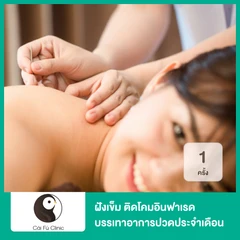 ฝังเข็ม ติดโคมอินฟาเรด บรรเทาอาการปวดประจำเดือน ประจำเดือนมาไม่ปกติ 1 ครั้ง