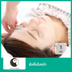 ฝังเข็มใบหน้า 1 ครั้ง