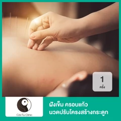 ฝังเข็ม ครอบแก้ว นวดปรับโครงสร้างกระดูก 1 ครั้ง