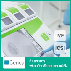 ทำ IVF/ICSI พร้อมย้ายตัวอ่อนรอบแช่แข็ง และตรวจโครโมโซมตัวอ่อน 4 ตัว