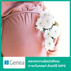 ตรวจความผิดปกติของทารกในครรภ์ ด้วยวิธี NIPS