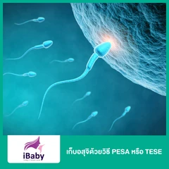 เก็บอสุจิด้วยวิธี PESA หรือ TESE