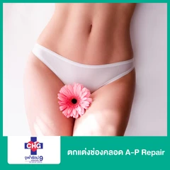 ตกแต่งช่องคลอด A-P Repair ที่ โรงพยาบาลจุฬารัตน์ 9 แอร์พอร์ต