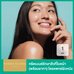 ทรีตเมนต์รักษาสิวที่ใบหน้า (พร้อมยาทา) โดยแพทย์ผิวหนัง 1 ครั้ง