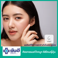 เสริมจมูก ด้วยซิลิโคนญี่ปุ่น สำหรับเคสแก้