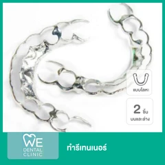 ทำรีเทนเนอร์ แบบโลหะ 2 ชิ้น ฟันบนและล่าง