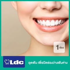 อุดฟัน เพื่อปิดช่องว่างฟันห่าง 1 ช่อง