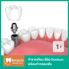 ทำรากฟันเทียม ยี่ห้อ Dentium พร้อมทำครอบฟัน สำหรับฟัน 1 ซี่