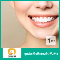 อุดฟัน เพื่อปิดช่องว่างฟันห่าง 1 ช่อง