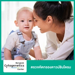 ตรวจคัดกรองดาวน์ซินโดรม Panorama Extended with Microdeletion Syndromes