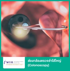 ส่องกล้องตรวจลำไส้ใหญ่ (Colonoscopy)