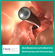 ส่องกล้องตรวจระบบทางเดินอาหาร (Gastroscopy and Colonoscopy)