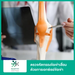 ตรวจคัดกรองข้อเข่าเสื่อม ด้วยการเอกซเรย์ข้อเข่า