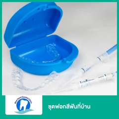ชุดฟอกสีฟันที่บ้าน