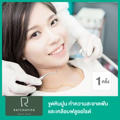 ขูดหินปูน ทําความสะอาดฟัน และเคลือบฟลูออไรด์ 1 ครั้ง