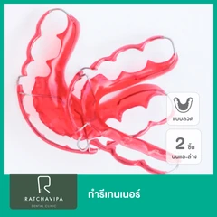 ทำรีเทนเนอร์แบบลวด 2 ชิ้น ฟันบนและล่าง