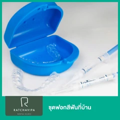 ชุดฟอกสีฟันที่บ้าน