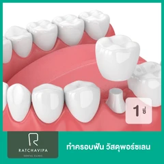 ทำครอบฟัน วัสดุพอร์ซเลน สำหรับฟัน 1 ซี่