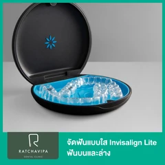 จัดฟันแบบใส Invisalign Lite ฟันบนและล่าง