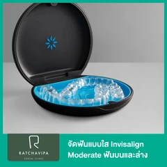 จัดฟันแบบใส Invisalign Moderate ฟันบนและล่าง