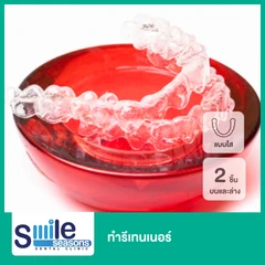 ทำรีเทนเนอร์แบบใส 2 ชิ้น ฟันบนและล่าง