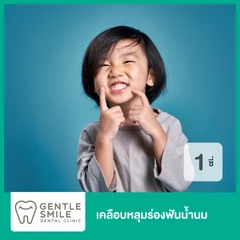 เคลือบหลุมร่องฟันน้ำนม 1 ซี่