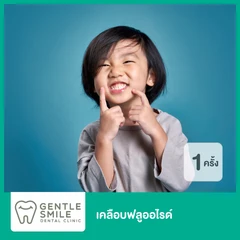 เคลือบฟลูออไรด์ 1 ครั้ง