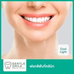 ฟอกสีฟันที่คลินิก ด้วยระบบ Cool Light