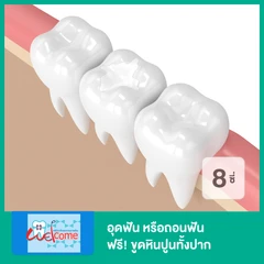 อุดฟัน หรือถอนฟัน 8 ซี่ ฟรี! ขูดหินปูนทั้งปาก