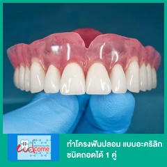 ทำฟันปลอม โครงอะคริลิก (พลาสติก) 1 คู่ ฟันบนและล่าง