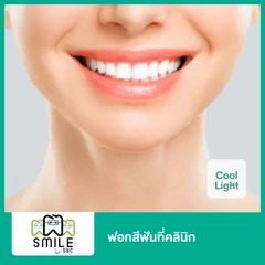 ฟอกสีฟันที่คลินิก ด้วยระบบ Cool Light