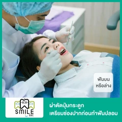 ผ่าตัดปุ่มกระดูก เตรียมช่องปากก่อนทำฟันปลอม สำหรับฟันบนหรือล่าง