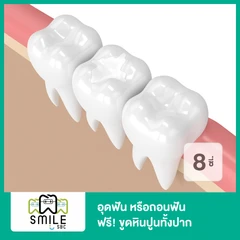 อุดฟัน หรือถอนฟัน 8 ซี่ ฟรี! ขูดหินปูนทั้งปาก