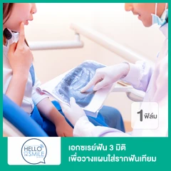 เอกซเรย์ฟัน 3 มิติ เพื่อวางแผนใส่รากฟันเทียม 1 ฟิล์ม