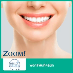 ฟอกสีฟันที่คลินิก ด้วยระบบ Zoom