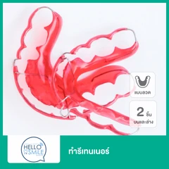 ทำรีเทนเนอร์แบบลวด 2 ชิ้น ฟันบนและล่าง