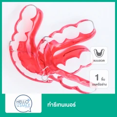 ทำรีเทนเนอร์แบบลวด 1 ชิ้น ฟันบนหรือล่าง