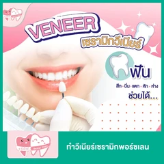 ทำวีเนียร์เซรามิกพอร์ซเลน สำหรับฟัน 1 ซี่