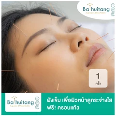 ฝังเข็ม เพื่อผิวหน้าดูกระจ่างใส ฟรี! ครอบแก้ว 1 ครั้ง