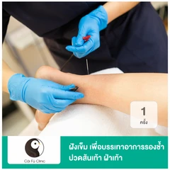 ฝังเข็ม กระตุ้นไฟฟ้า เพื่อบรรเทาอาการรองช้ำ ปวดส้นเท้า ฝ่าเท้า 1 ครั้ง