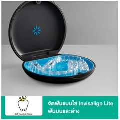 จัดฟันแบบใส Invisalign Lite ฟันบนและล่าง