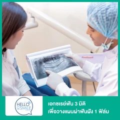 เอกซเรย์ฟัน 3 มิติ เพื่อวางแผนผ่าฟันฝัง 1 ฟิล์ม