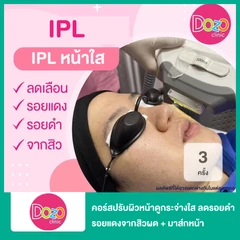 คอร์สปรับผิวหน้าดูกระจ่างใส ลดรอยดำรอยแดงจากสิวผด ด้วย IPL + มาส์กหน้า เพิ่มความกระจ่างใส 3 ครั้ง