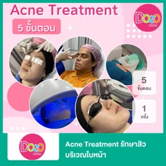 Acne Treatment รักษาสิว บริเวณใบหน้า 5 ขั้นตอน 1 ครั้ง
