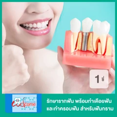 รักษารากฟัน พร้อมทำเดือยฟัน และทำครอบฟัน ด้วยโลหะเคลือบพอร์ซเลน สำหรับฟันกราม หรือ ฟันหน้า 1 ซี่