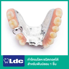 ทำโครงโลหะชนิดถอดได้ สำหรับฟันปลอม 1 ชิ้น