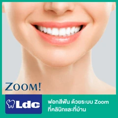 ฟอกสีฟัน ด้วยระบบ Zoom ที่คลินิกและที่บ้าน