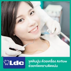 ขูดหินปูน ขัดฟันด้วยเครื่อง Airflow ช่วยขจัดคราบติดแน่น