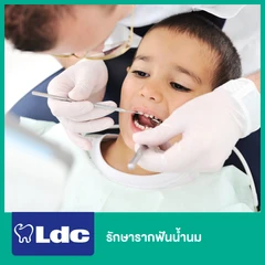 รักษารากฟันน้ำนม